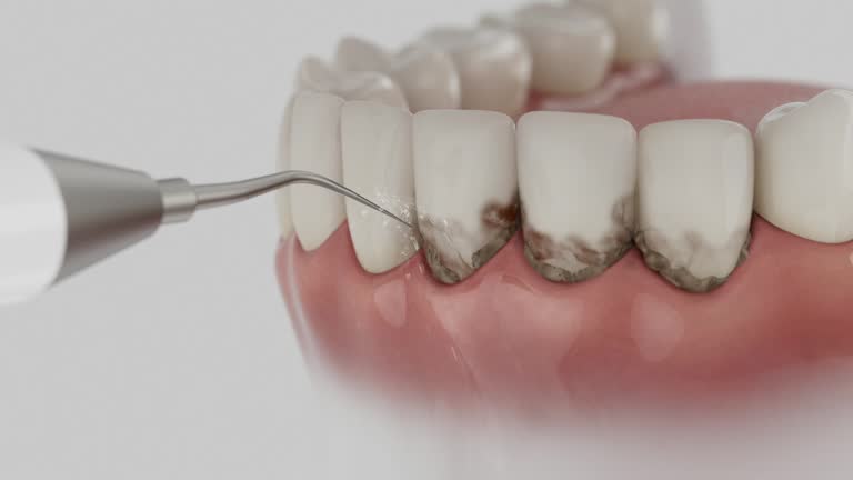 Trusted Dental Crowns And Bridges service in Wadsworth, OH - Dentist Open Now